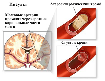 давление